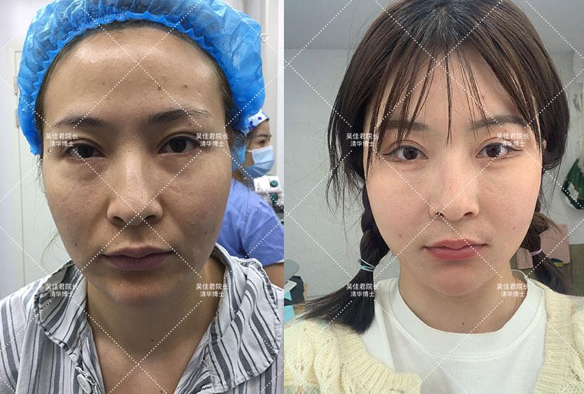 管家波一肖一码100精准与警惕虚假宣传-全面释义、统计解答解释落实